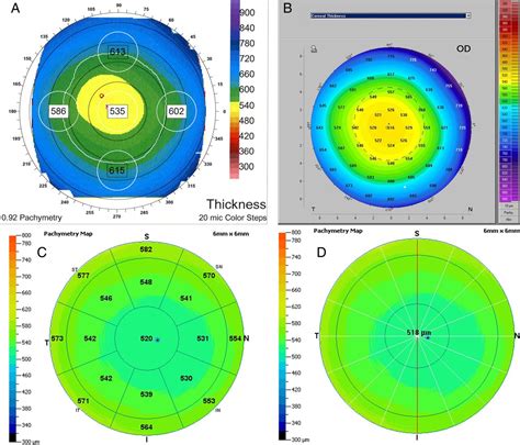 instrument measures thickness of cornea|corneal thickness measurement.